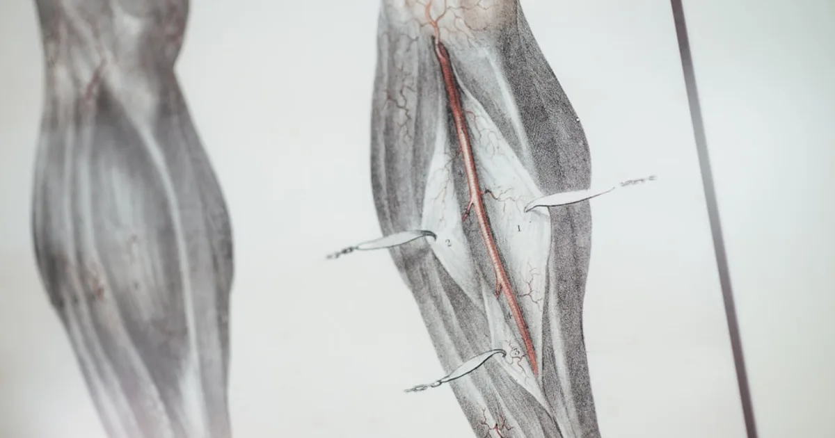 Planche anatomique illustrant le réseau veineux de la jambe